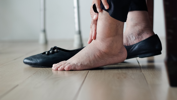 What’s Causing Swollen Feet and Ankles?