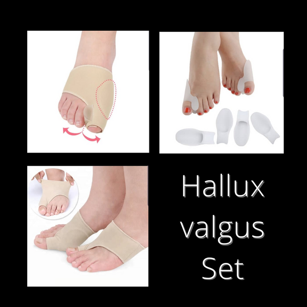 Hallux valgus Set1